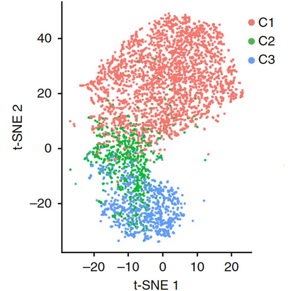 UMAP of scRNAseq data for macrophages post lung injury.